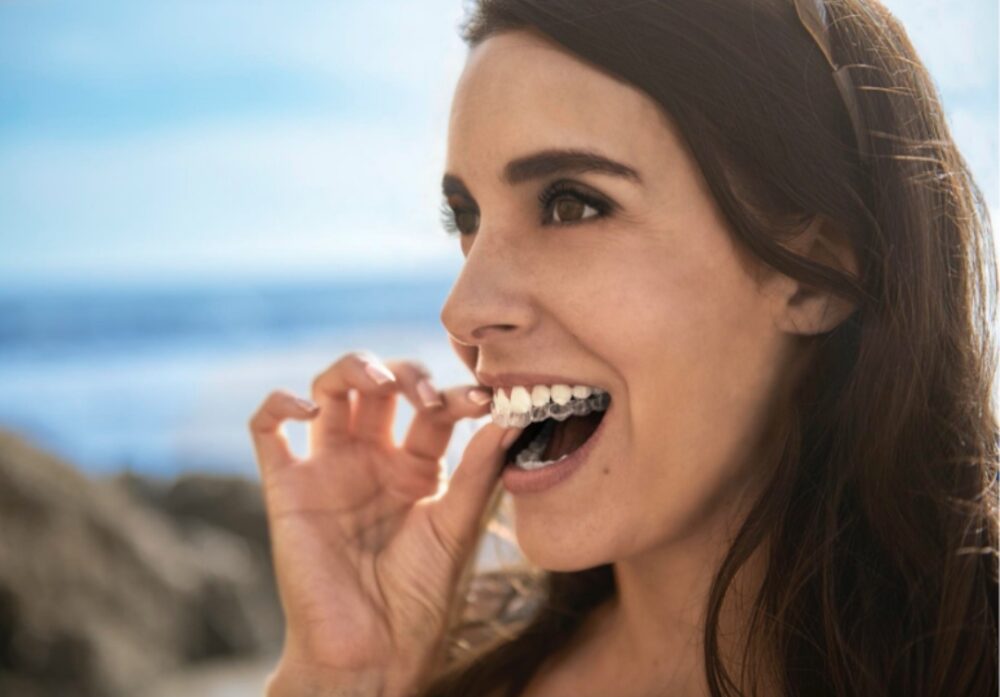 3 Συμβουλές σχετικά με τη διαδικασία Invisalign